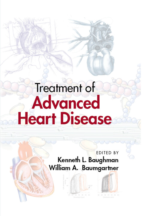 Treatment of Advanced Heart Disease 