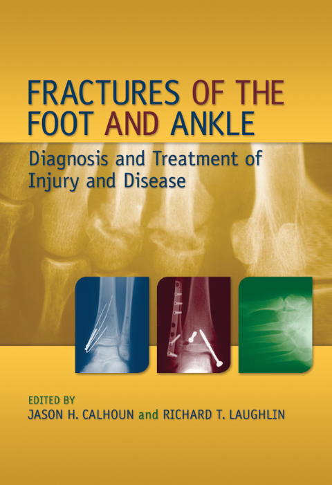 Cover image for book Fractures of the Foot and Ankle