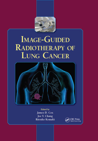 Image-Guided Radiotherapy of Lung Cancer