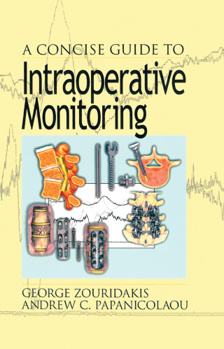 A Concise Guide to Intraoperative Monitoring