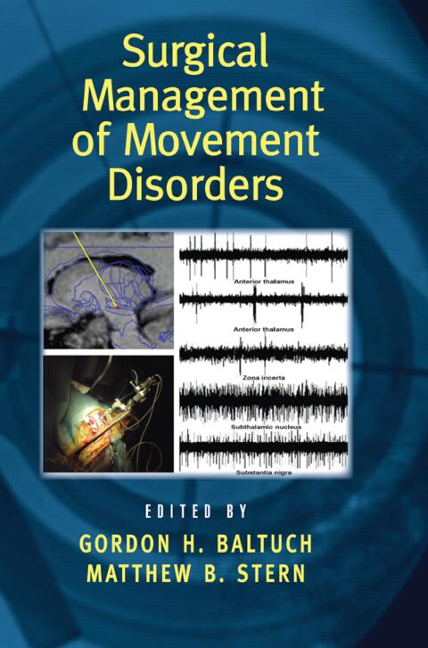 Cover image for book Surgical Management of Movement Disorders