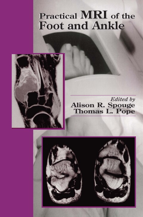 Cover image for book Practical MRI of the Foot and Ankle