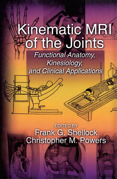 Cover image for book Kinematic MRI of the Joints