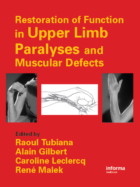 Cover image for book Restoration of Function in Upper Limb Paralyses and Muscular Defects
