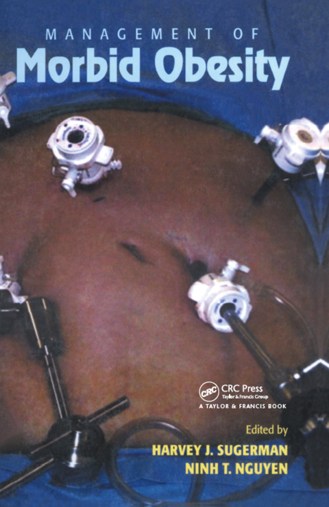 Cover image for book Management of Morbid Obesity