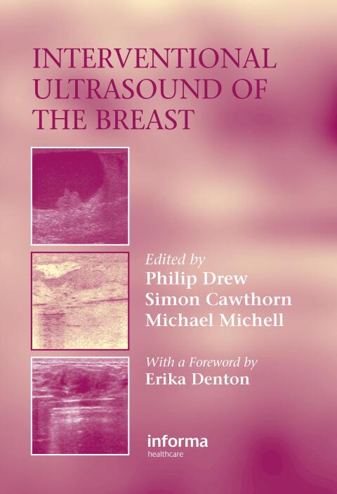 Cover image for book Interventional Ultrasound of the Breast