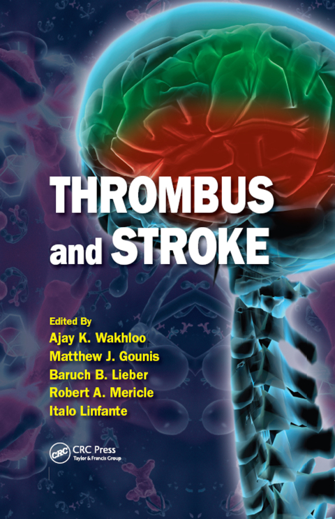 Cover image for book Thrombus and Stroke