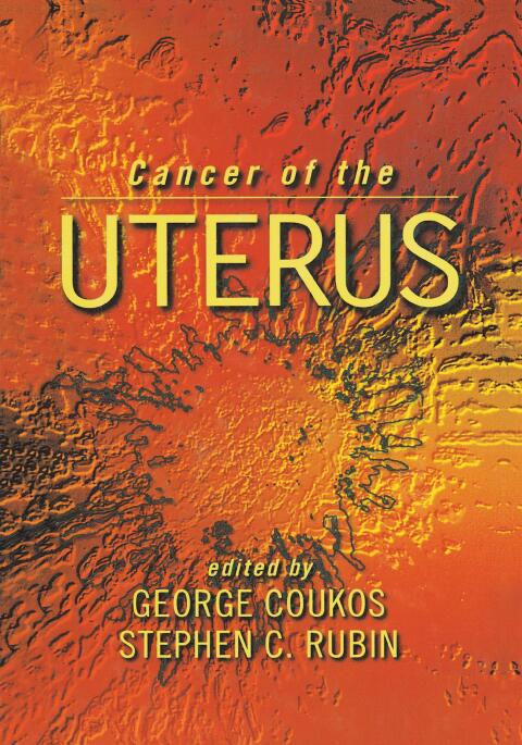 Cover image for book Cancer of the Uterus