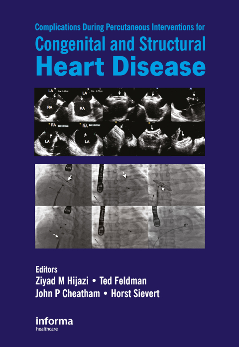 Cover image for book Complications During Percutaneous Interventions for Congenital and Structural Heart Disease