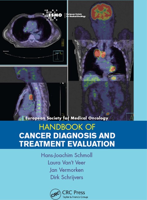 Cover image for book ESMO Handbook of Cancer Diagnosis and Treatment Evaluation