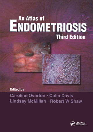 Atlas of Endometriosis