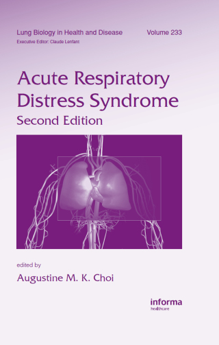 Acute Respiratory Distress Syndrome