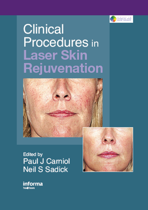 Cover image for book Clinical Procedures in Laser Skin Rejuvenation