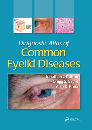 Diagnostic Atlas of Common Eyelid Diseases