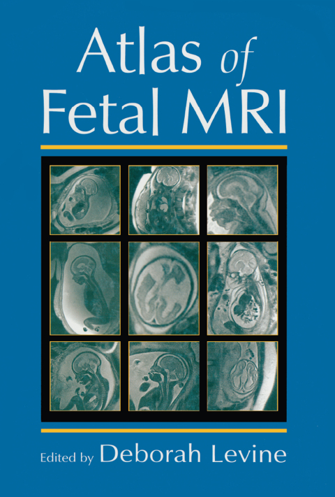 Cover image for book Atlas of Fetal MRI