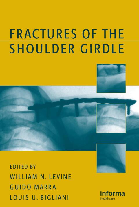 Cover image for book Fractures of the Shoulder Girdle
