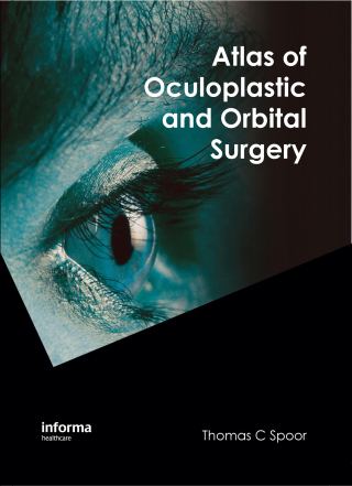 Atlas of Oculoplastic and Orbital Surgery