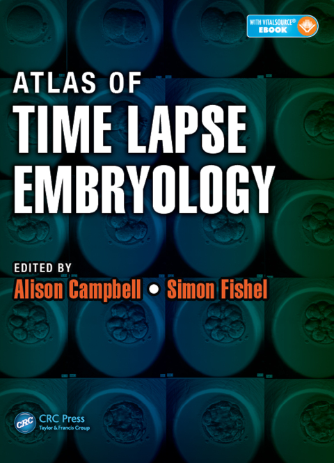 Cover image for book Atlas of Time Lapse Embryology
