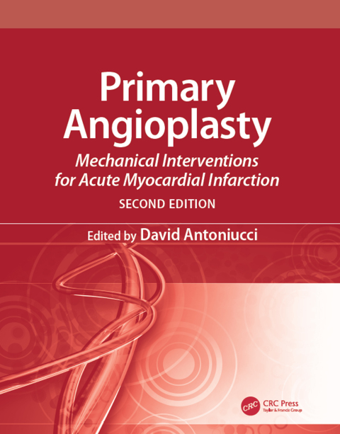 Cover image for book Primary Angioplasty