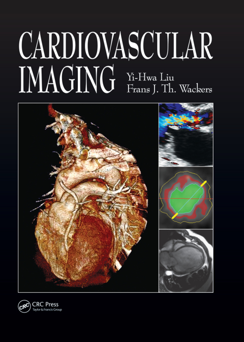 Cardiovascular Imaging 