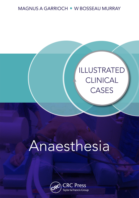 Cover image for book Anaesthesia