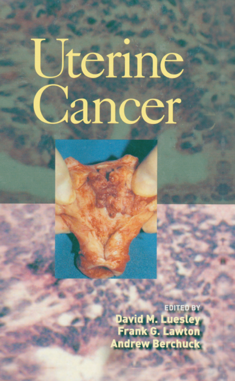 Cover image for book Uterine Cancer