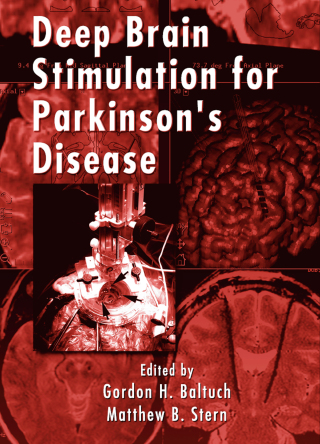 Deep Brain Stimulation for Parkinson's Disease