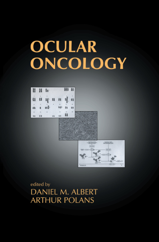 Ocular Oncology
