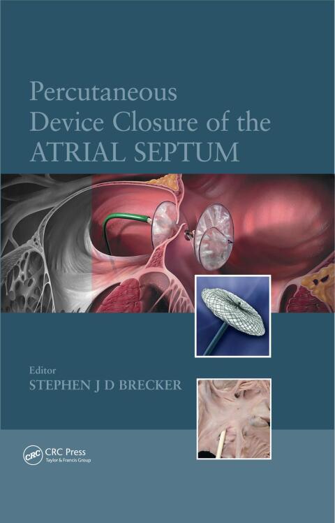 Cover image for book Percutaneous Device Closure of the Atrial Septum
