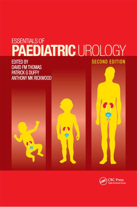 Cover image for book Essentials of Paediatric Urology