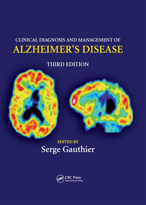 Cover image for book Clinical Diagnosis and Management of Alzheimer's Disease