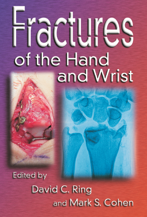 Cover image for book Fractures of the Hand and Wrist