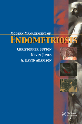 Modern Management of Endometriosis