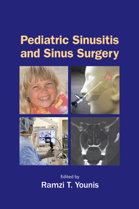 Cover image for book Pediatric Sinusitis and Sinus Surgery