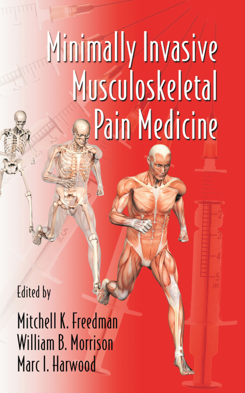 Cover image for book Minimally Invasive Musculoskeletal Pain Medicine