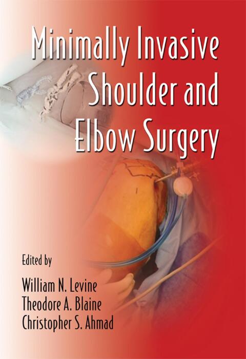 Cover image for book Minimally Invasive Shoulder and Elbow Surgery