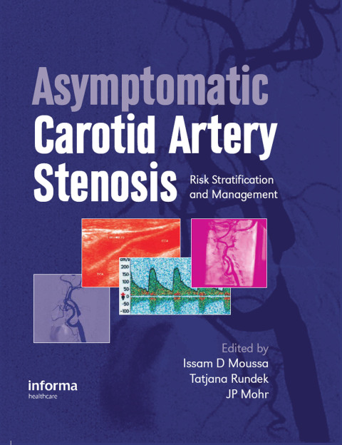 Cover image for book Asymptomatic Carotid Artery Stenosis