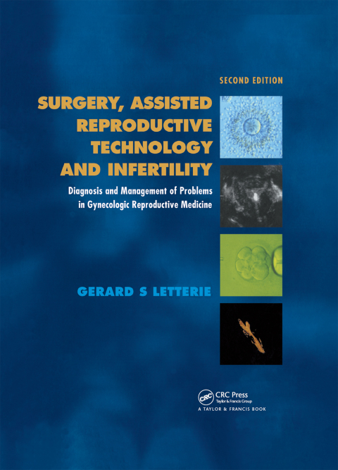 Cover image for book Surgery, Assisted Reproductive Technology and Infertility