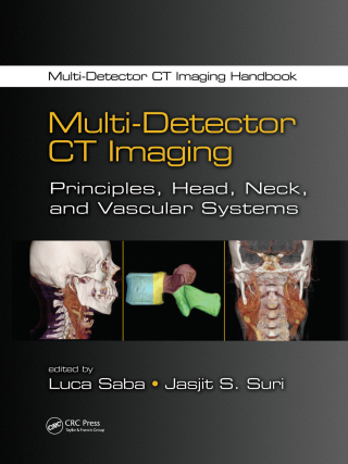 Multi-Detector CT Imaging