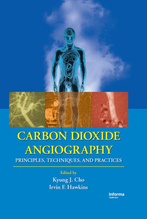 Cover image for book Carbon Dioxide Angiography