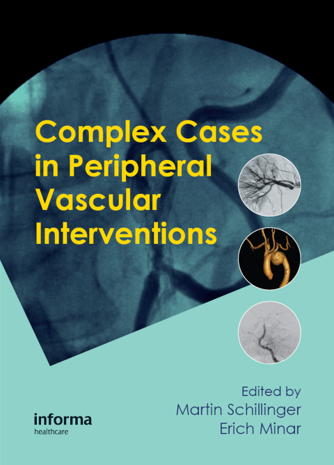 Cover image for book Complex Cases in Peripheral Vascular Interventions
