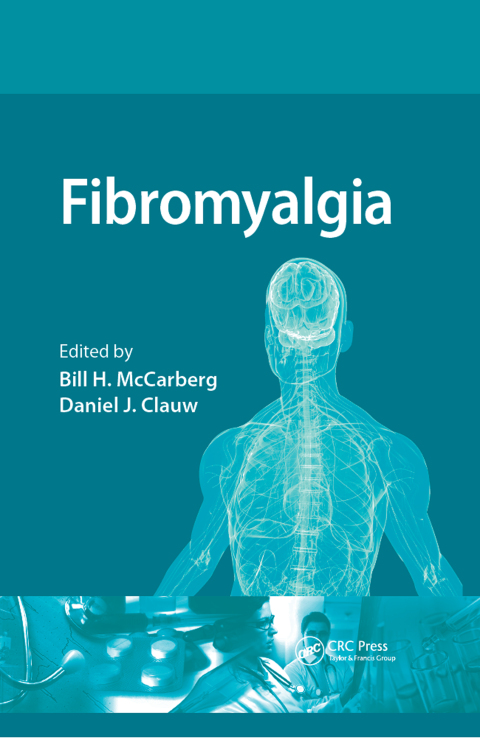 Cover image for book Fibromyalgia