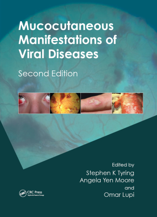 Mucocutaneous Manifestations of Viral Diseases