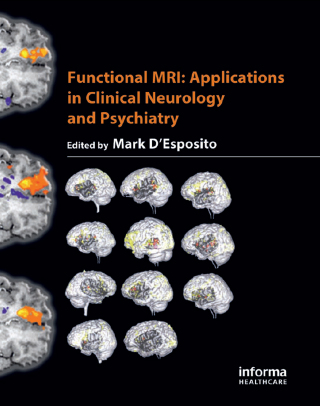 Functional MRI