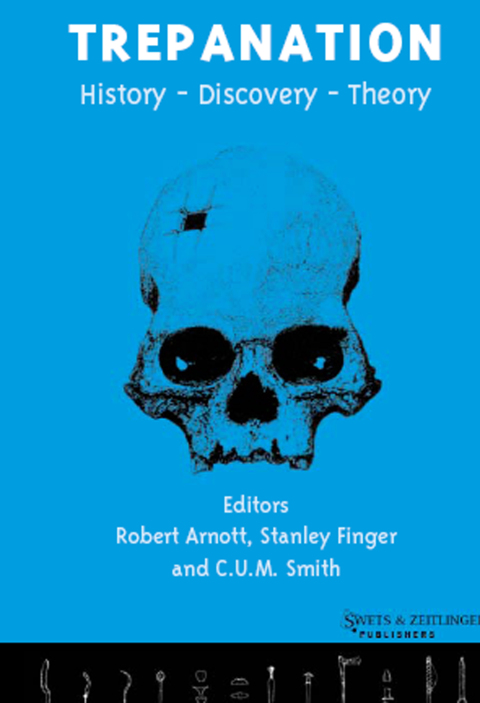 Cover image for book Trepanation