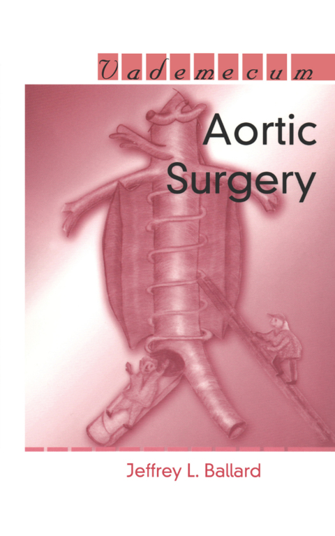 Cover image for book Aortic Surgery