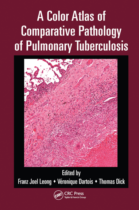Cover image for book A Color Atlas of Comparative Pathology of Pulmonary Tuberculosis