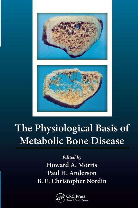 Cover image for book The Physiological Basis of Metabolic Bone Disease