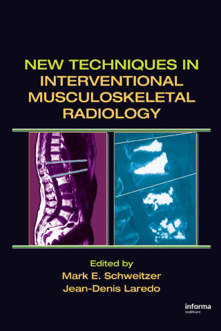 New Techniques in Interventional Musculoskeletal Radiology