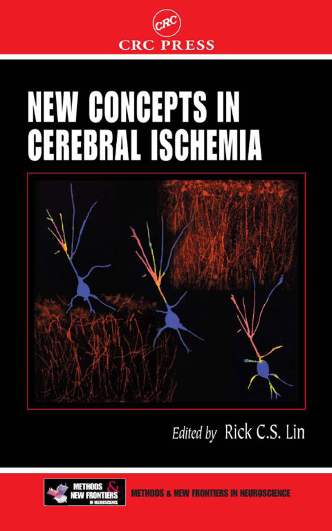 Cover image for book New Concepts in Cerebral Ischemia